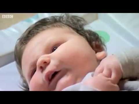 20 طبيب لولادة أكبر مولود في العالم